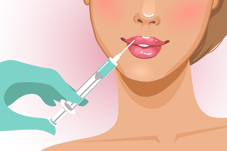 ヒアルロニダーゼで唇のフィラーを溶解する：必要なユニット数は？