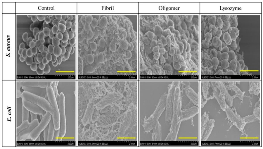 Antimicrobial effect of lysozyme.