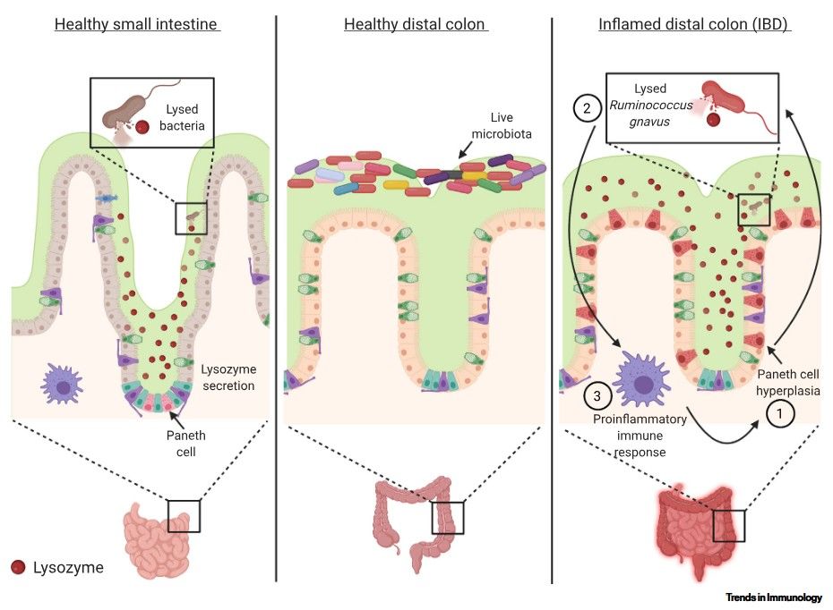 Lysozyme is a potent target for therapeutic modulation in inflammatory bowel disease.