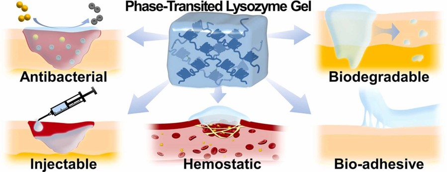 Phase-transited lysozyme gel.