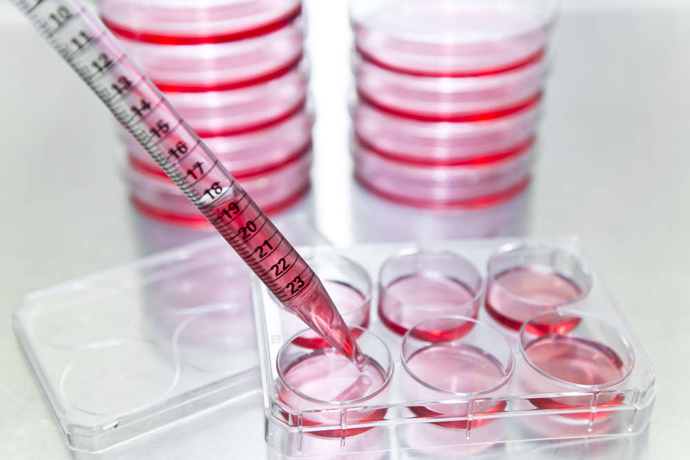Mammalian cell-based enzyme expression