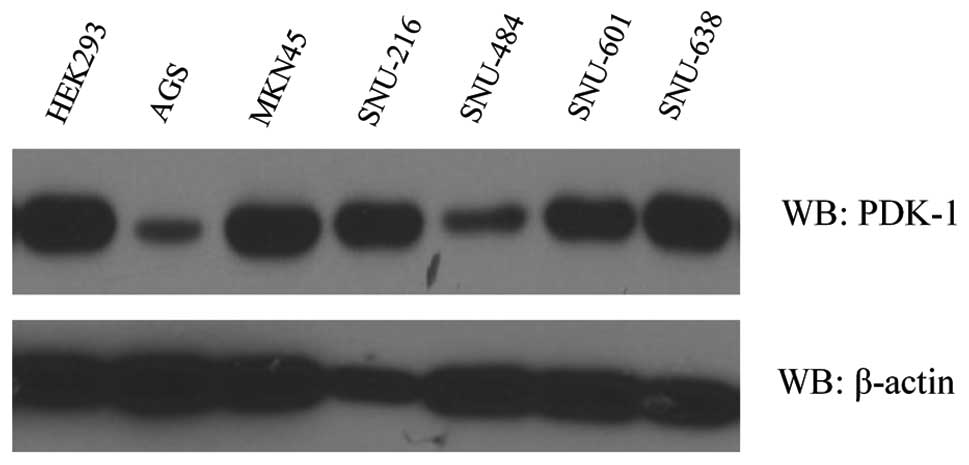 Expression of pyruvate dehydrogenase kinase-1 in gastric cancer as a potential therapeutic target