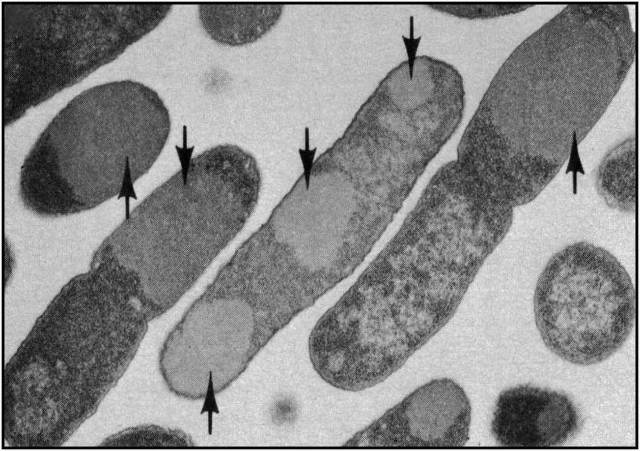 Molecular chaperones in protein folding