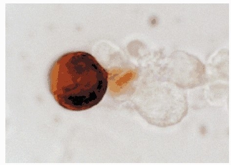 ウサギ抗マウスレニン抗体を用いたJGCにおけるレニンタンパク質の免疫染色